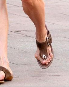 明星的畸形脚,揭秘畸形脚背后的故事